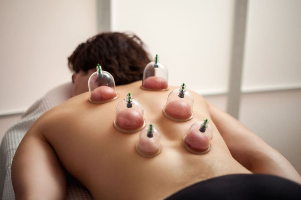 Terapia cu ventuze